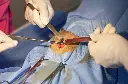 Surgery.webp