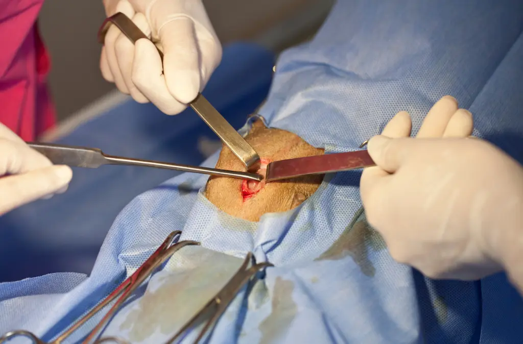 Surgery.webp