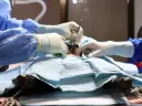 Programa de Anestesia y Cirugía Abdominal